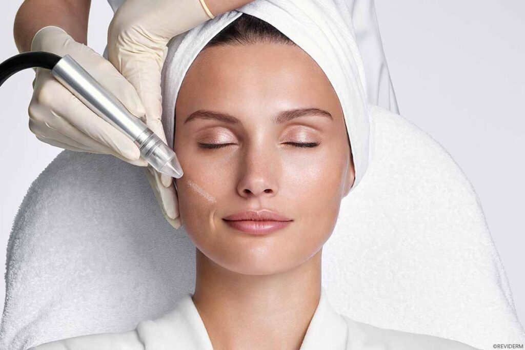 mikrodermabrasion