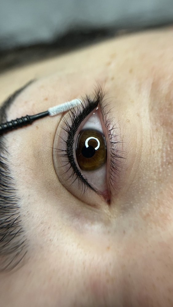 Wimpernkranzverdichtung